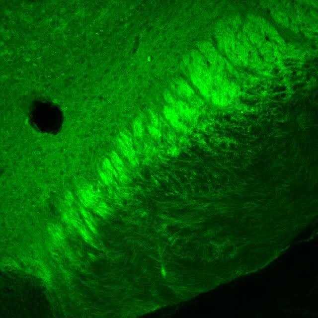 Fixation (histology) Wikiwand