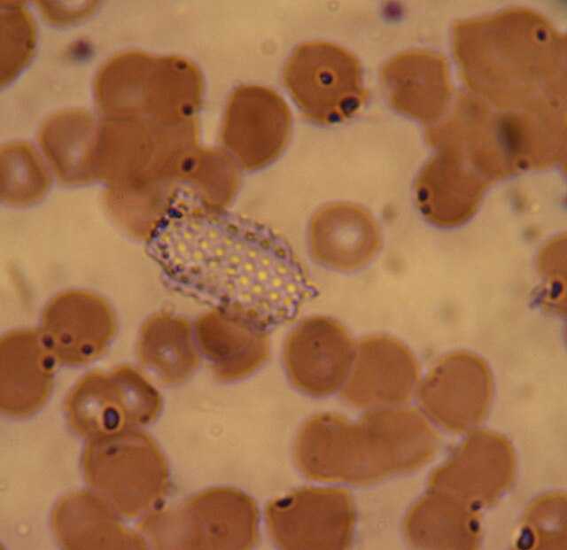 Artefacto (error de observación) Wikiwand