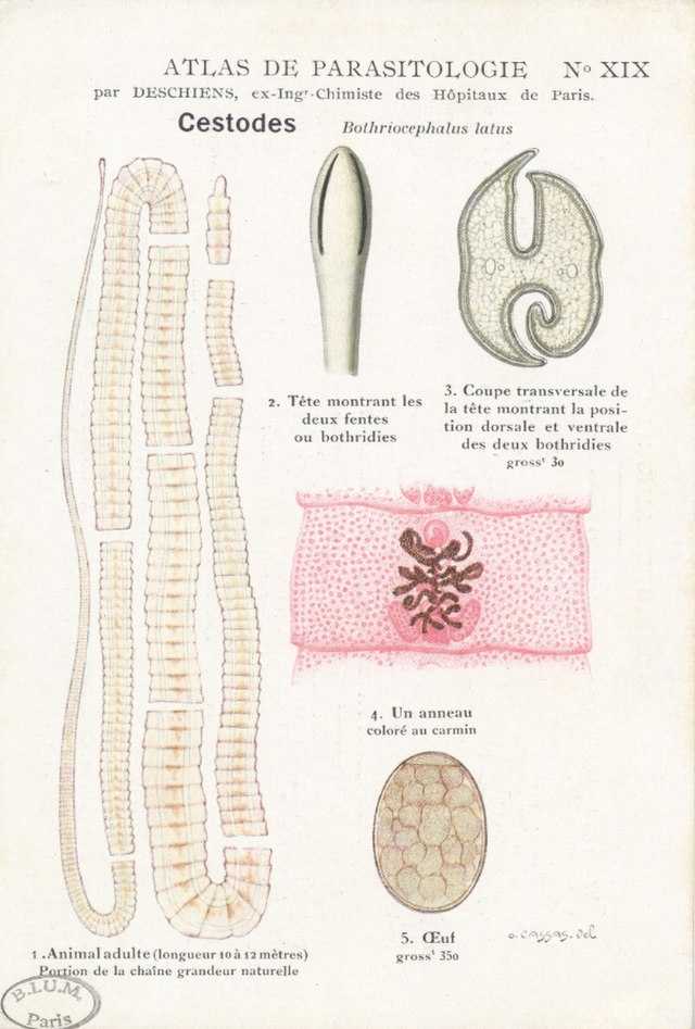 Diphyllobothriasis Wikiwand